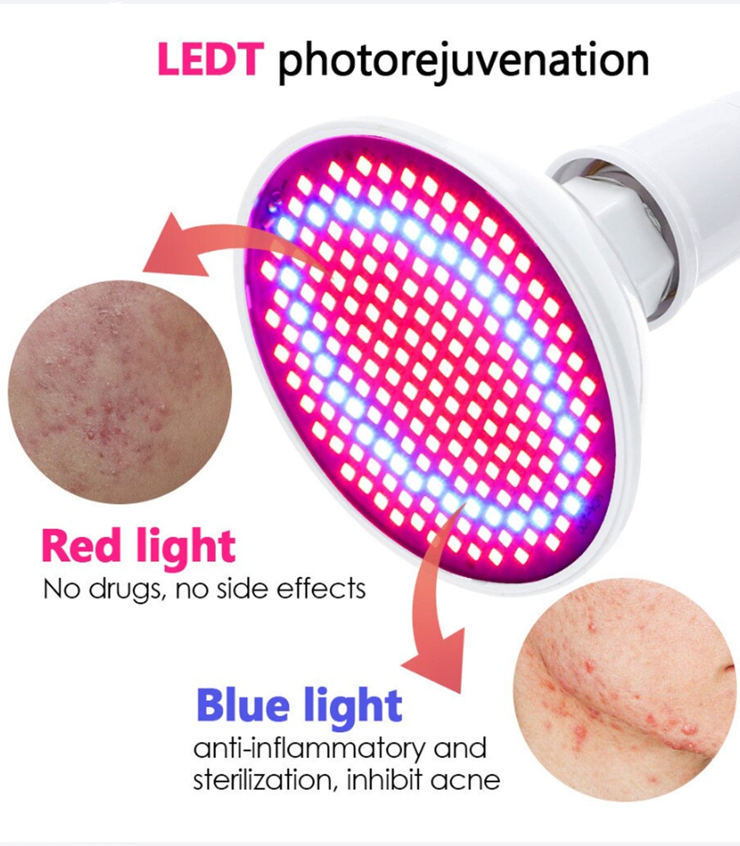 LED Red & Blue Light Skin Care Device — 200 LED Beauty Lamp for At-Home Face Care by Sereniya