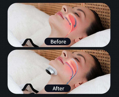 Sereniya Sleep Aid Device for Improved Breathing & Snoring Support