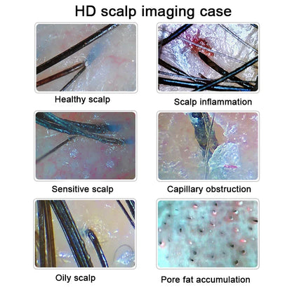 Professional HD Skin & Hair Analyzer — Digital Scalp Scanner Beauty Device for At-Home & Salon Use by Sereniya
