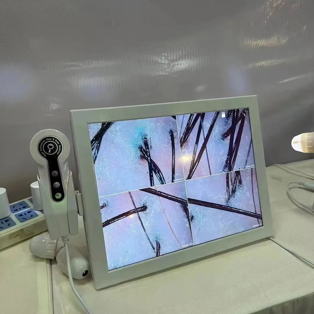Professional HD Skin & Hair Analyzer — Digital Scalp Scanner Beauty Device for At-Home & Salon Use by Sereniya